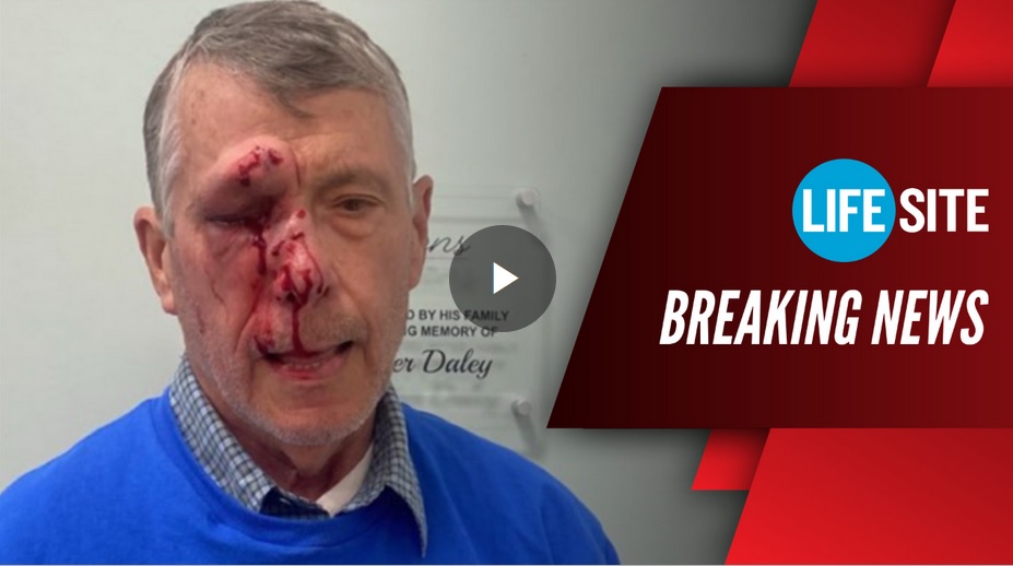 Triggered Victim Of Planned Parenthood Thugs