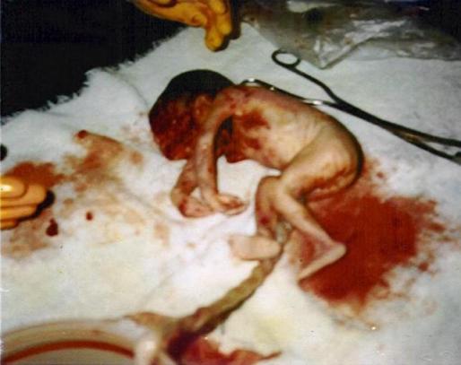 abortion womans right or murder Abortion should not be considered murder if the fetus is not value women’s reproductive rights the right to refuse an abortion completely or to. abortion womans right or murder Abortion should not be considered murder if the fetus is not value women’s reproductive rights the right to refuse an abortion completely or to.